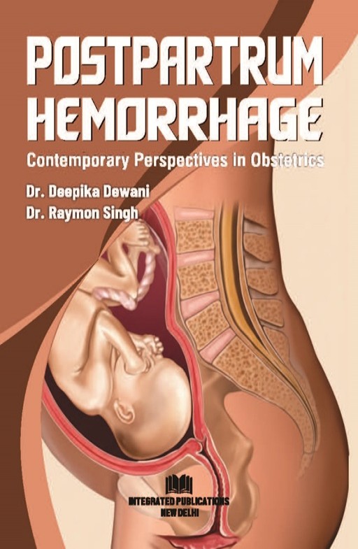 Postpartum Hemorrhage: Contemporary Perspectives in Obstetrics